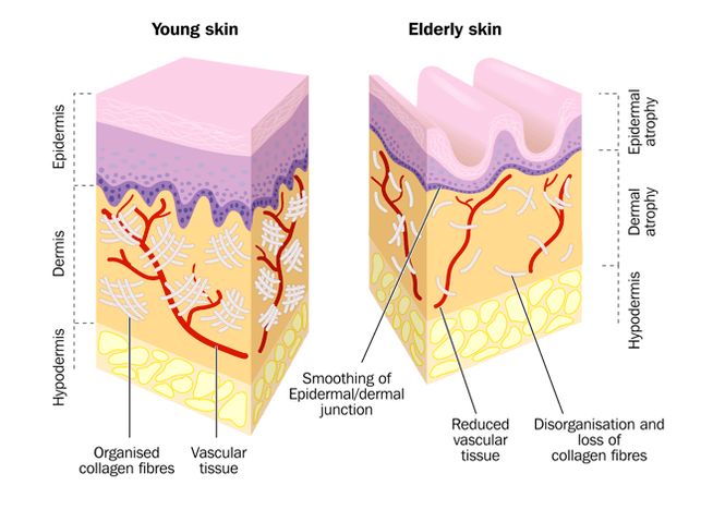 skin aging